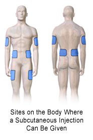Picture of person showing subcutaneous shot sites