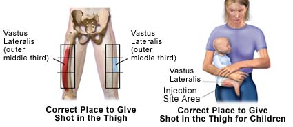 Pictures of the correct place to give a shot in the thigh