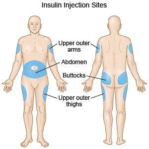 Types of injectable testosterone