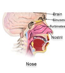 EPISTAXIS - Care Guide