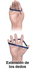 Picture of finger extension exercises